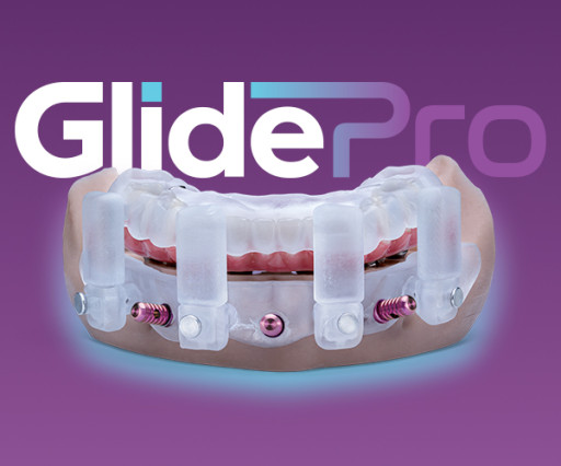 Glidewell Unveils GlidePRO(TM): A Restorative-Driven, Fully Guided Solution for Full-Arch Implant Cases