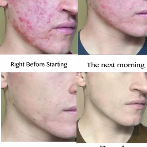 Buzzfeed's Shocking 'As Seen on TV' Product Review Hits Record Numbers