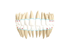 3D AI-Generated Mouth Model