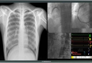 HYBRIDPIXX 4K 8MP Cath Lab Display