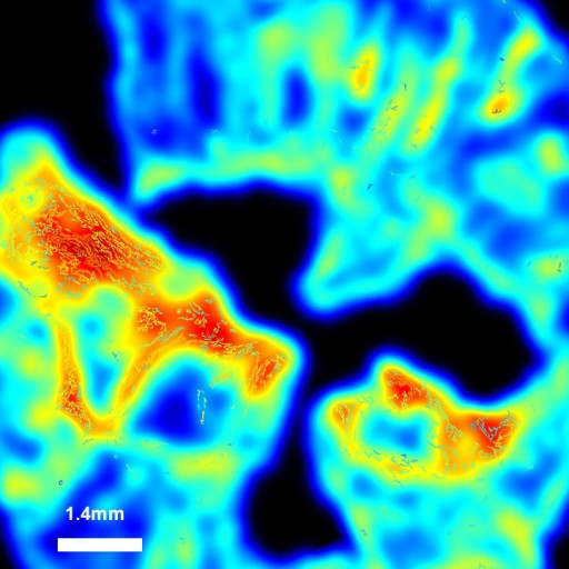PharmaNest to Present Five Digital Pathology and AI Communications at Digestive Disease Week 2026 Showcasing Advances in Fibrosis Research on IBD and EoE