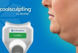 coolmini-coolsculpting-nyc