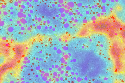 PharmaNest, NIH and VCU Launch Confirmatory Retrospective Outcome Study With 1,765 Patients to Advance AI-Driven Digital Pathology in MASLD