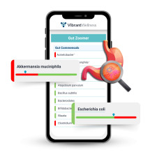 Gut Zoomer Sample Report Mockup