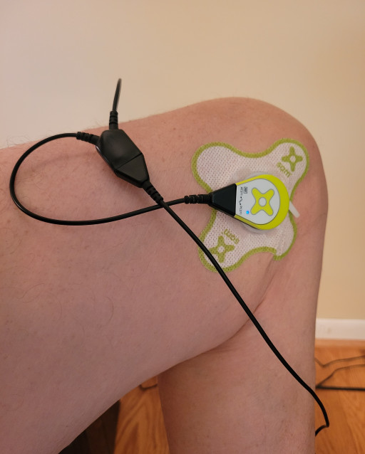 ZetrOZ Systems' sam Wearable Ultrasound Device Helps Osteoarthritis Patient Get Back to Living