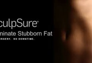 SculpSure