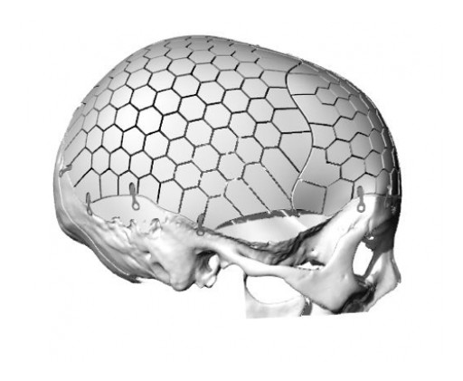 Swedish Research Provides Solution for Untreatable Patients