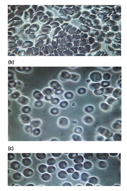 Victory Nutrition International Inc. (VNI) Announces Results of a Placebo-Controlled 1-Way Crossover Clinical Trial on a Finished Product