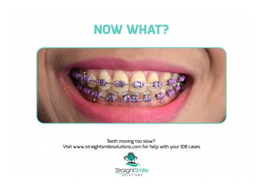 StraightSmile Solutions™- Orthodontic Consulting Launches Convenient, Digital, Hands-On Orthodontic Training and Consulting