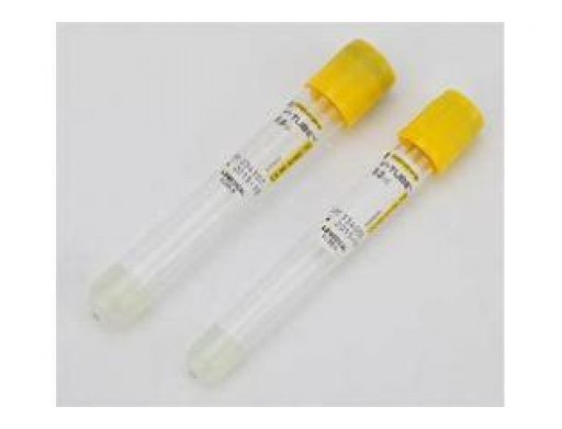 Global Serum Separating Tubes Sales Market Report 2018