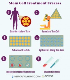 How Stem Cell Therapy Works