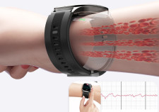 AI digital health mornitor