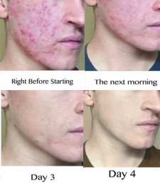 The results of BuzzFeeds product review