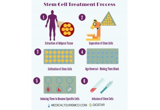 How Stem Cell Therapy Works
