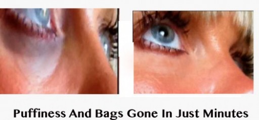 26-Year-Old Turns Down Second Multi-Million-Dollar Offer to Sell Secret Behind Revolutionary Organic Eye Cream