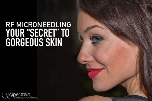 This Anti-Aging Treatment Will Have Everyone in Awe of Your 'Secret' to Youthful Skin