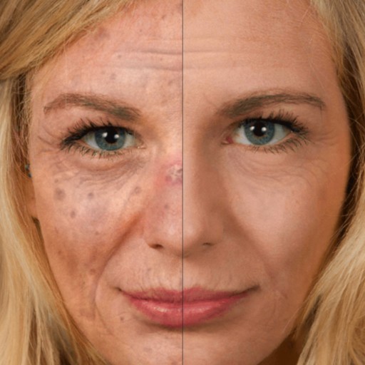 New Selfie-App Helps to Prevent Skin Cancer