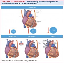 Central Illustration for Coronary Artery Bypass Grafting With and Without Manipulation of the Ascending Aorta
