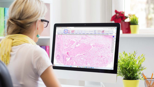 CORRECTING and REPLACING: Tribun Health Achieves FDA Clearance for CaloPix Digital Pathology Platform With Dual Scanner Compatibility