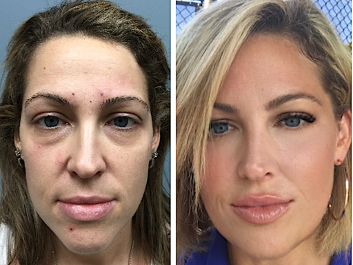 Dr. Dusan Sajic Provides Advanced Skin Rejuvenation, Skin Tightening Treatments in Guelph