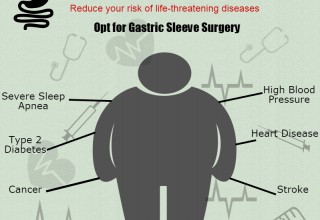 Bariatric Surgery 