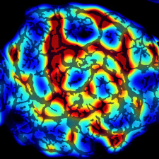 FibroNest quantification of a InSphero 3D InSight™ Human Liver NASH Model
