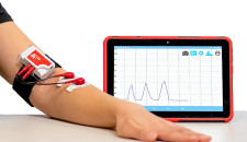 JOGO Health_Mayo Clinic_Parkinsons