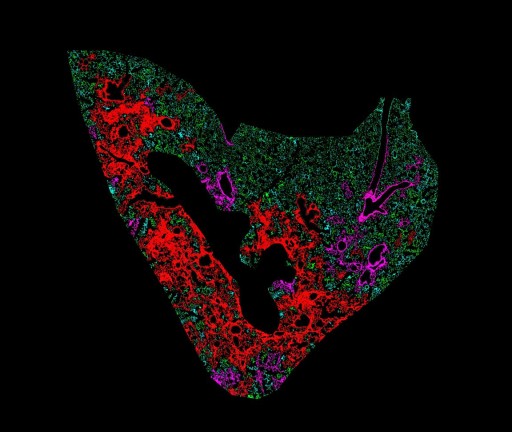 PharmaNest Announces Kidney and Lung Fibrosis Quantification Data to Be Presented at the 2020 Fibrosis and Tissue Repair Keystone Symposium