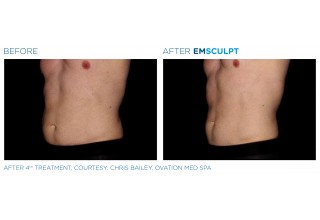 Before and After- Male