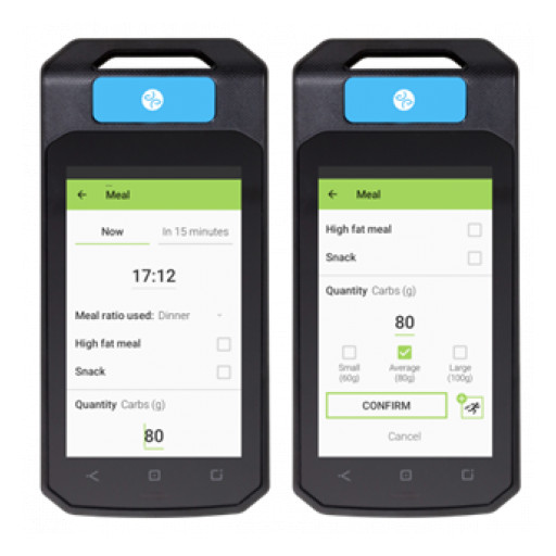 12-month real-world achievements for Diabeloop's AID