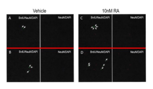 Study Shows Neumentix™ Enhances New Nerve Cell Growth in Rat Hippocampal Cells