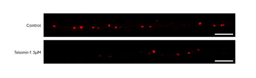 Telomir Pharmaceuticals Announces Telomir-1 Significantly Reduced Tumor Growth and Metastases in Aggressive Triple-Negative Breast Cancer Animal Models
