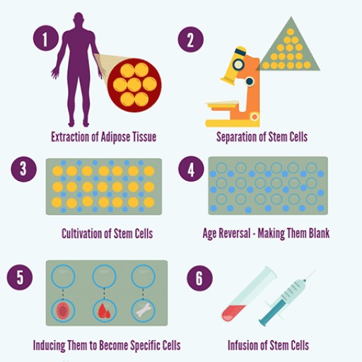 Medical Tourism Corporation Announces Stem Cell Therapy in Mexico With GIOSTAR