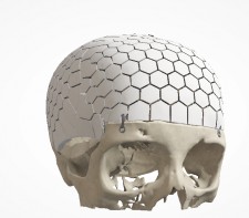 Digital image of the reconstruction