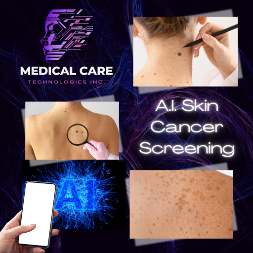 Medical Care Technologies Inc. Launches AI Platform for Early Basal Cell Carcinoma Detection