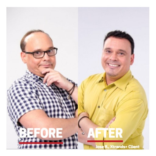 Hair Club® Highlights Proven Hair Loss Solutions  in Celebration of National Men's Health Week