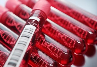 Blood Tubes with DNA inside