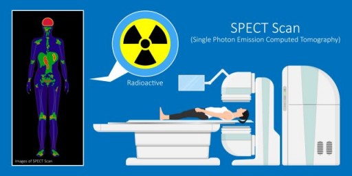 Global SPECT and SPECT-CT Market to Obtain Over US $1.90 Billion by 2025