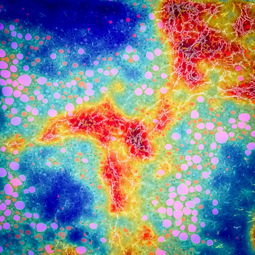 PharmaNest to Present Eight Digital Pathology and AI Abstracts at the International Liver Congress 2022