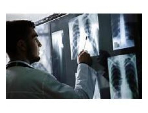 Diagnostic X-Ray Imaging Market Demand by 2025: QY Research
