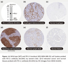 PD-L1 Antibody [HL1041] IHC