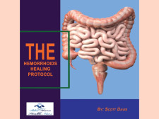Hemorrhoids Healing Protocol Review 2025