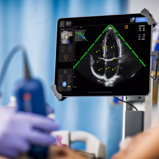 EchoNous Launches New Ultrasound Platform With High-End Features on Apple iOS