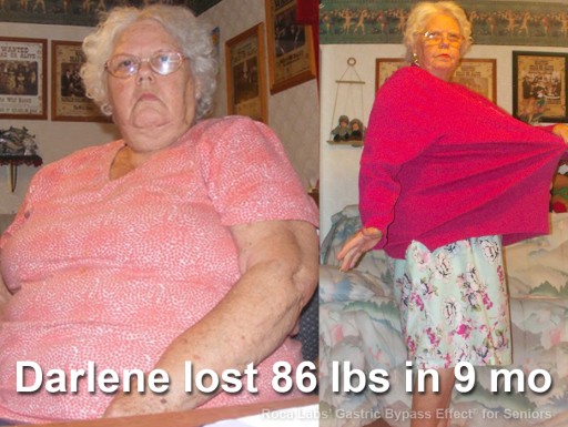 Senior Dropped 86 Lb Using Non-Surgical Roca Labs Regimen