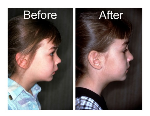 90% of Young Children in the Crosshair, Reports Medical Organization