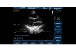 DICOM Viewer Preview