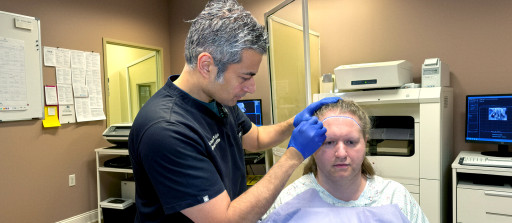 Who Accepts Insurance for Transgender Hair Transplant?