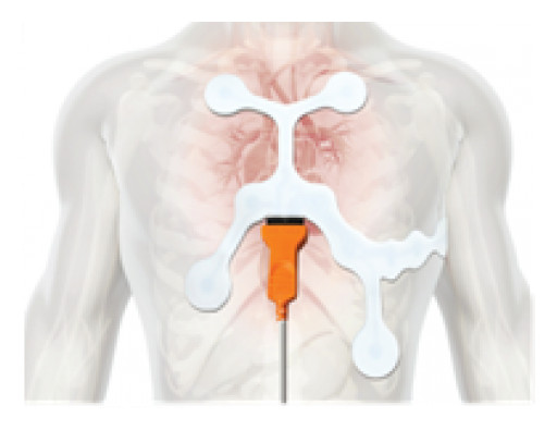 TridentCare Announces National Partnership for Mobile EKG Solution