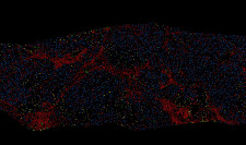 FibroNest Digital Pathology Tissue Panel